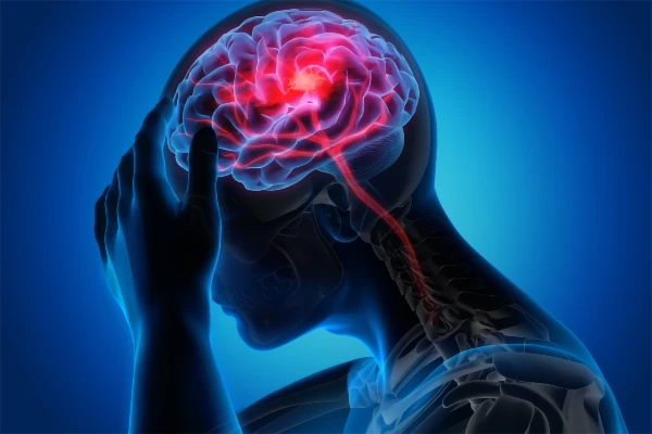 Stroke Awareness Month